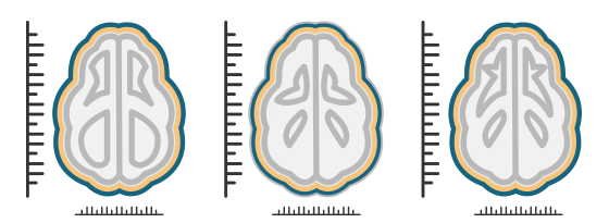 How can we predict which patients will benefit from a certain treatment?