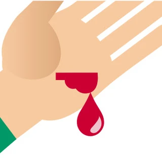 Illustratie van een grote bloeddruppel die uit een snee in de hand valt