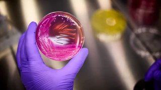 Tecnico di laboratorio che esamina una coltura microbica
