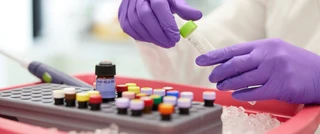 Roche diagnóstico del laboratorio