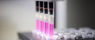 Close-up of a laboratory machine processing test tubes with pink liquid for analysis.