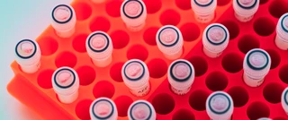 Red laboratory rack holding multiple small, labeled test tubes with caps, arranged in neat rows, suggesting a scientific setting.